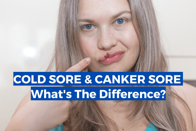 Cold Sore vs Canker Sore