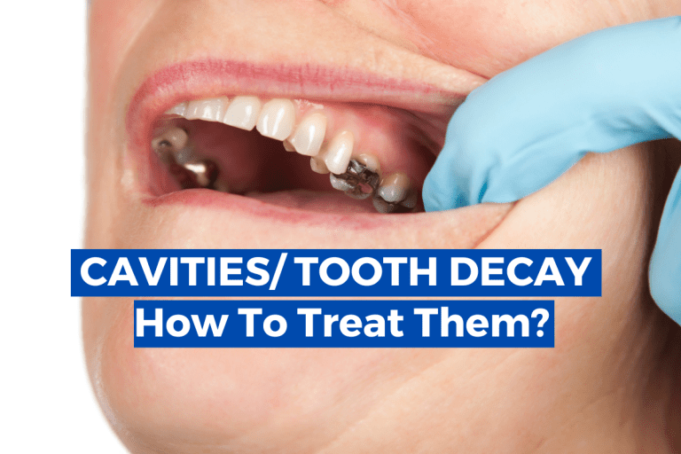 Tooth Decay