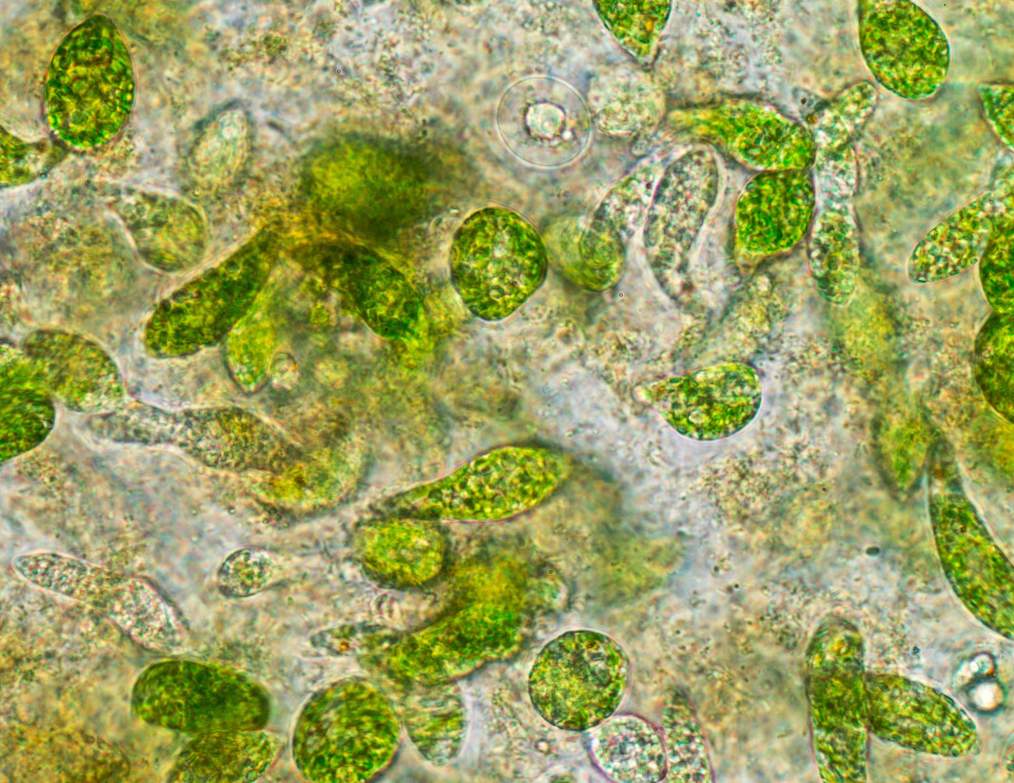 Best Super Greens for Gut Health and Improved Digestion