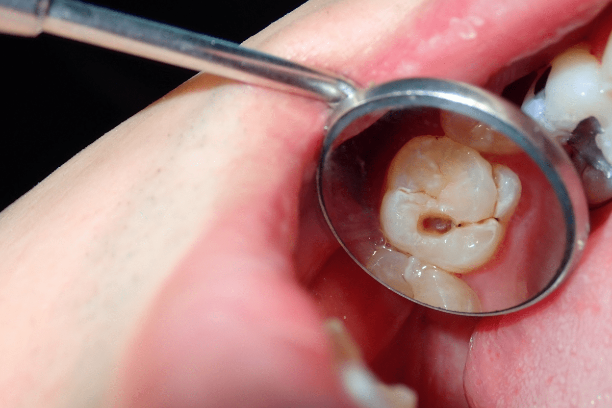 Common Dental Problems
